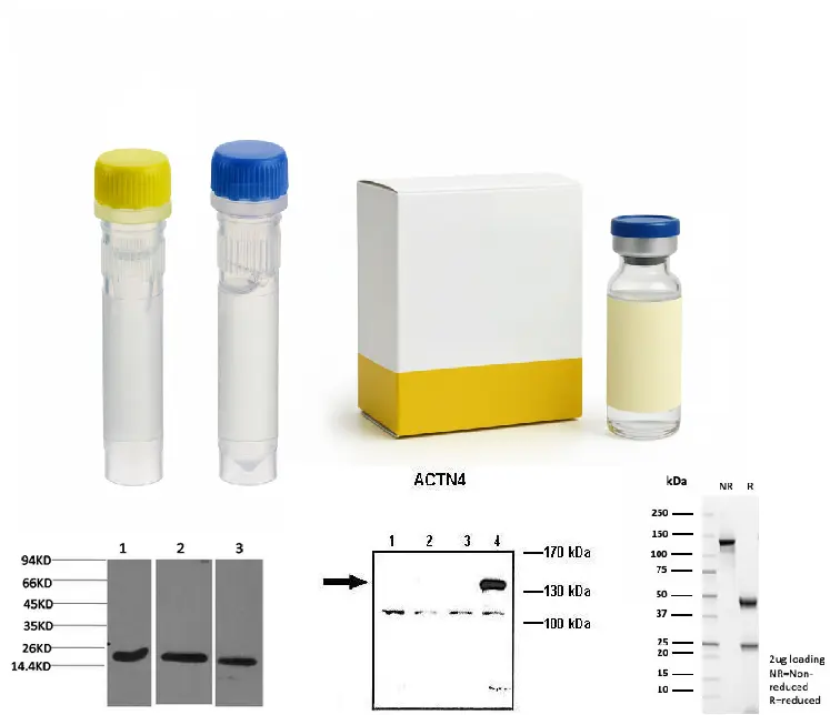  ATF1 Mouse Monoclonal Antibody