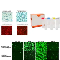 0610010K14Rik-set siRNA/shRNA/RNAi Lentivector (Mouse)